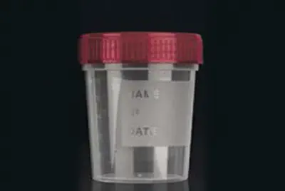Pots Prelevements Rouges Pot de prélèvement 120 ml non stérile avec bouchon rouge